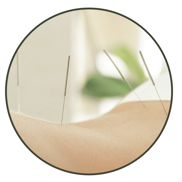 palms acupuncture treatment lower back pain 600